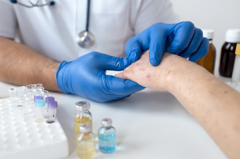 Measles Cases Rise to 15: Why Measles Still a Concern?