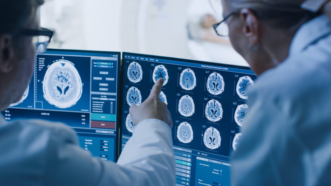 A UNM scientist studies brain scans on a computer, focusing on highlighted areas that reveal hidden glioblastoma cells linked to cancer recurrence.