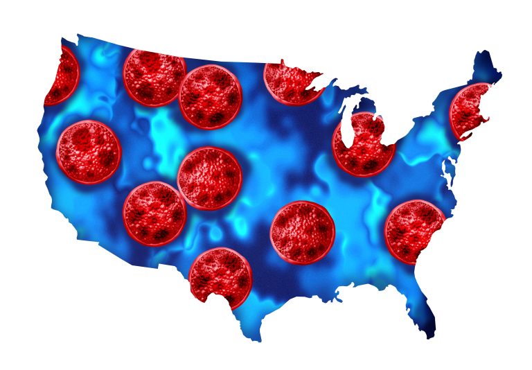 Could Lettuce Be The Cause of Cyclospora? This Is What Health Officials Say